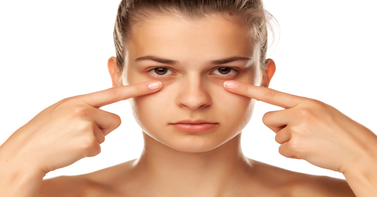 8 Ways to Conquer Under Eye Bags I AM Medical Spas and Laser Centers